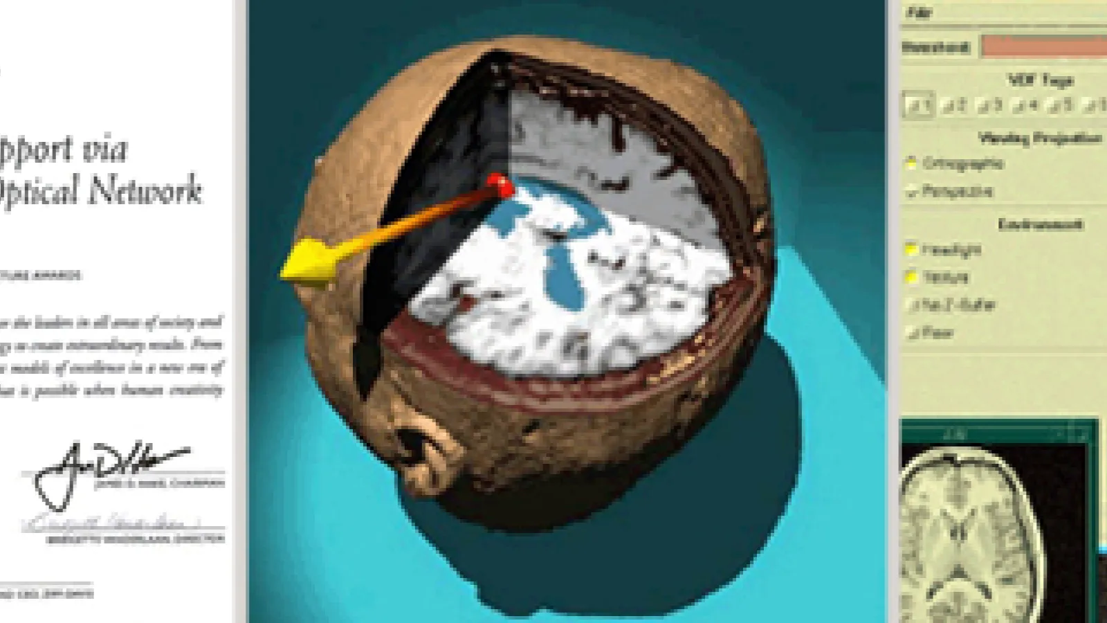 Certificate and Cell - Brain imaging
