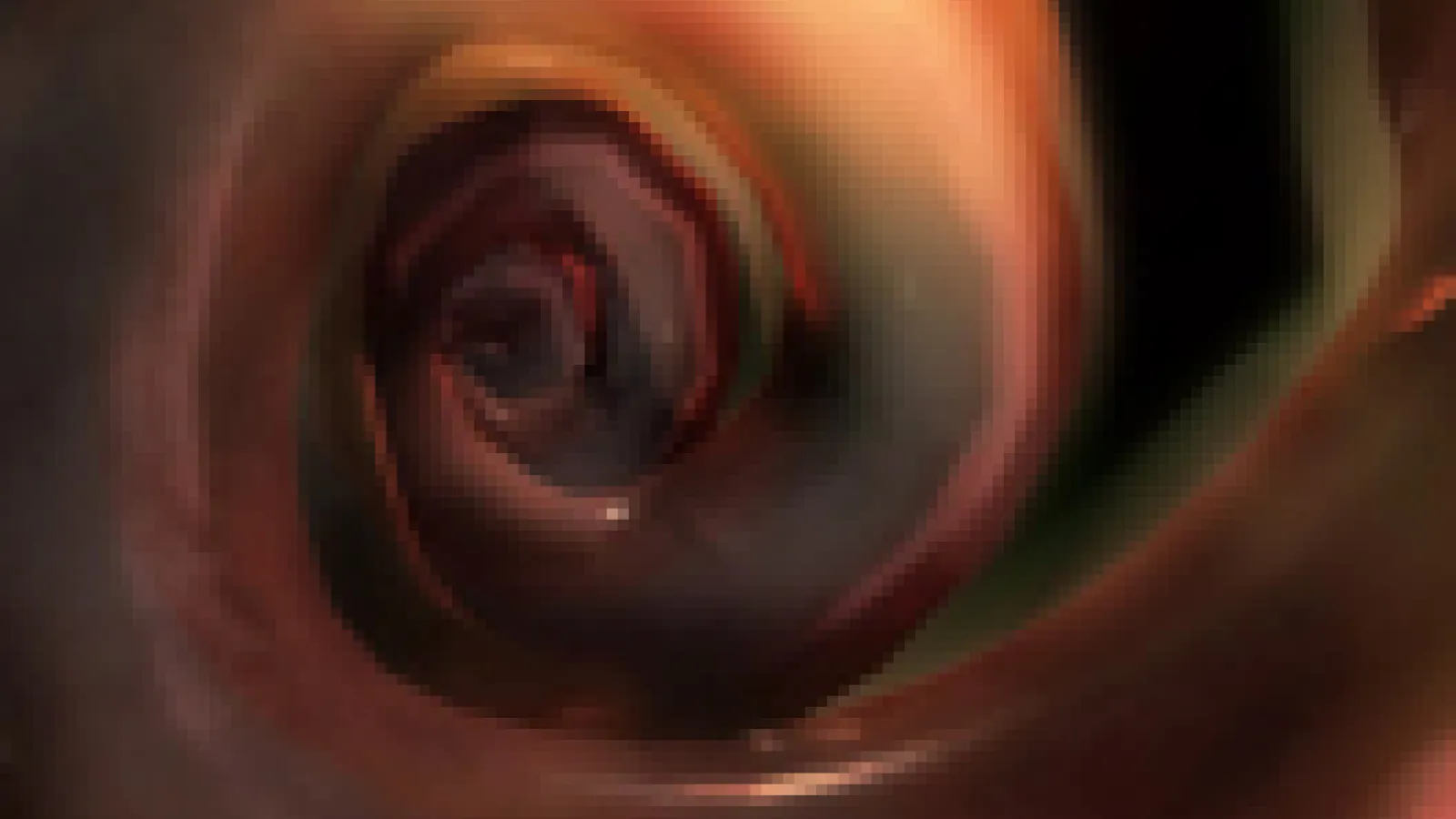 Benign Paroxysmal Positional Vertigo Thumbnail